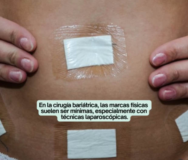 Las cicatrices son parte del proceso, no del destino