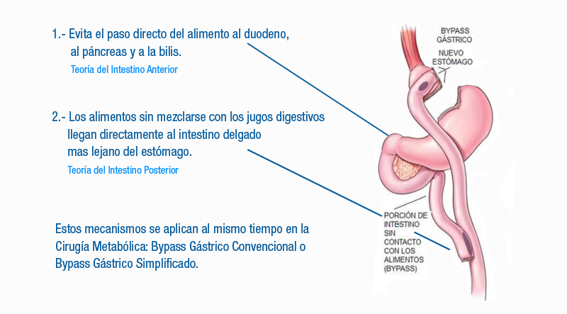 Definición de cirugía metabólica