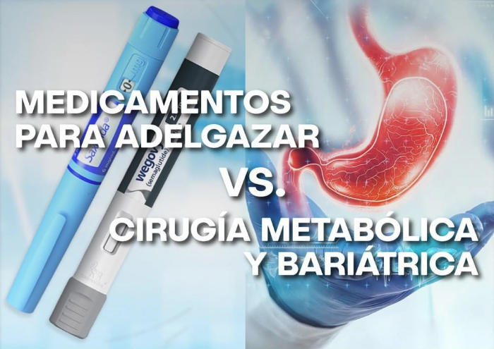 Medicamentos para adelgazar vs. cirugía metabólica y bariátrica