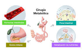 Qué es la cirugía metabólica?